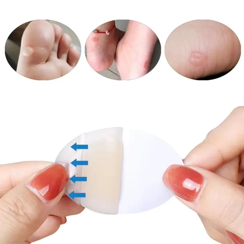 10pcs Hydrocolloid Pads Dressing Heel Tape Anti-Wear Band-Aid Adhesive Bandage Outdoor Camping Hiking Accessories